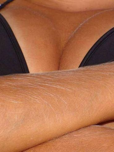 There Are Several Close-Up Photos Of Lori Anderson's Amazing Long White Arm Hair